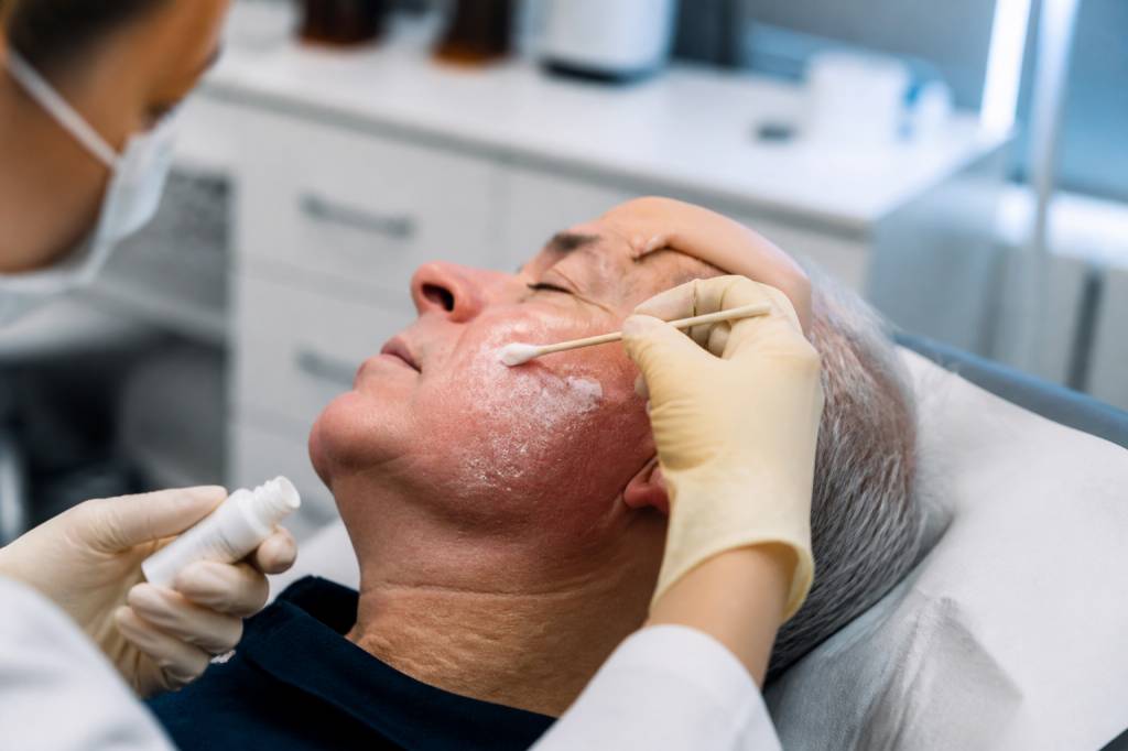 5 fluorouracil : usages et effets secondaires en dermatologie