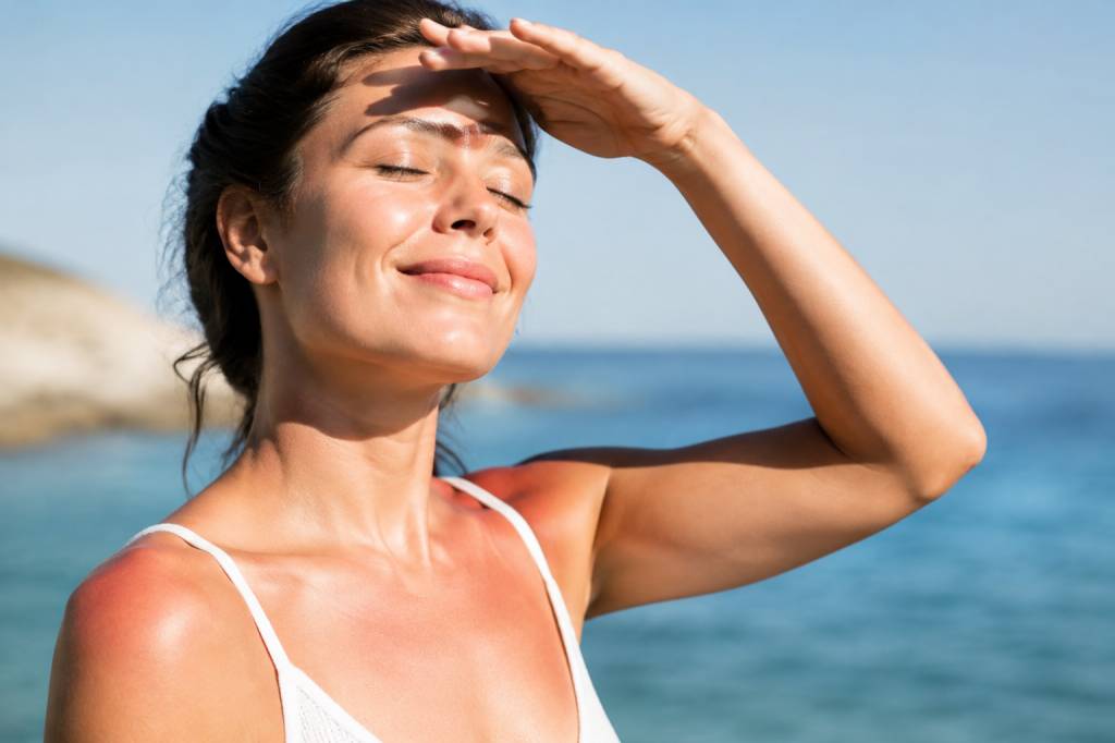Coups de soleil : quel remède naturel privilégier ?
