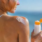 Coup de soleil : quoi mettre pour apaiser la peau ?